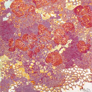 Queen’s Lace II by Heather Page is a 15" square relief print on paper of a swirl of intricate lace-like lichens & fossils in springtime reds, purples, & golds